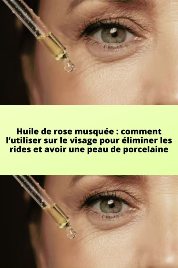 Sécurité huile de rose