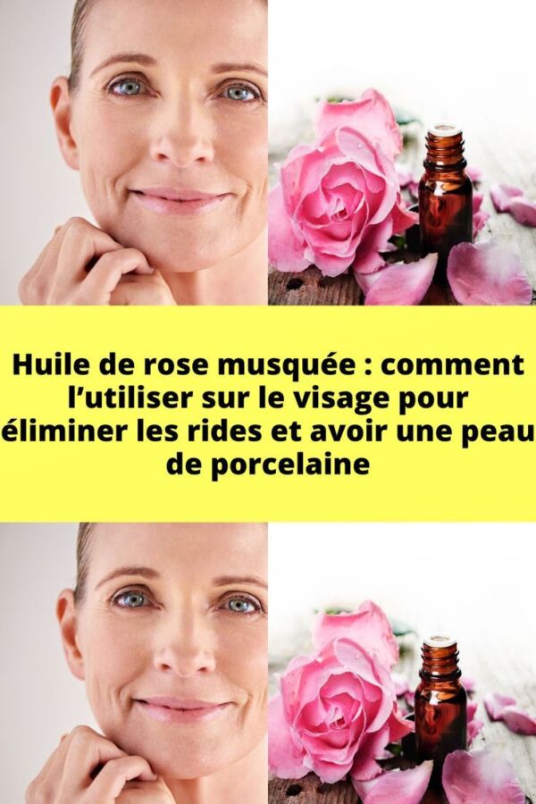 Précautions huile de rose