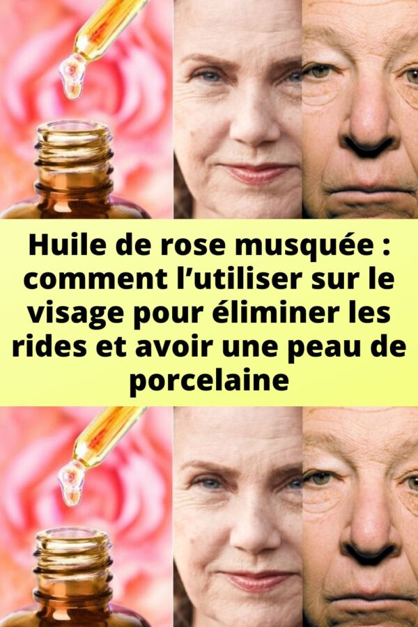 Sécurité huile de rose